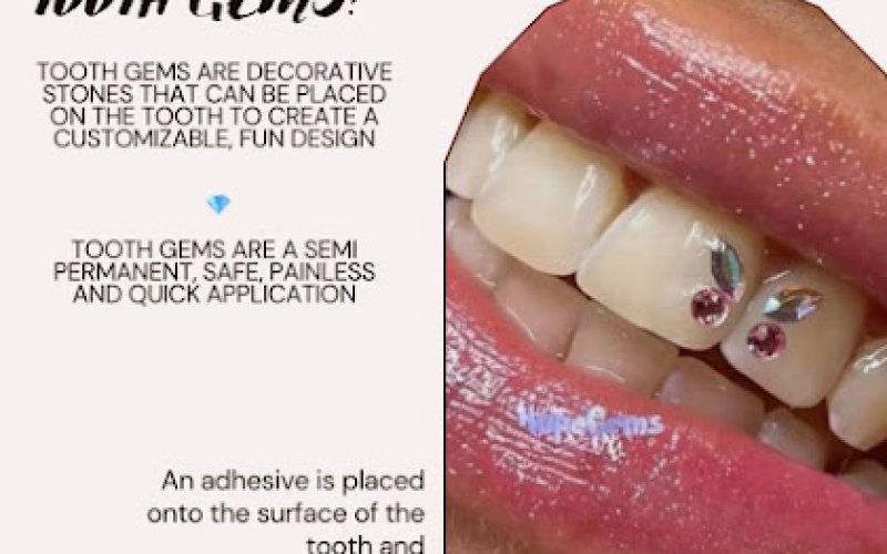 Tooth Gems by Serenity Jewelry