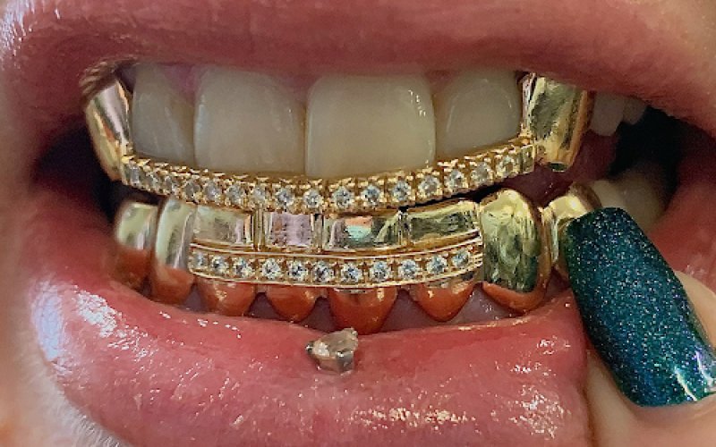 The Plug Jewelry & Grillz Gold Teeth — Jewelry store in Richmond